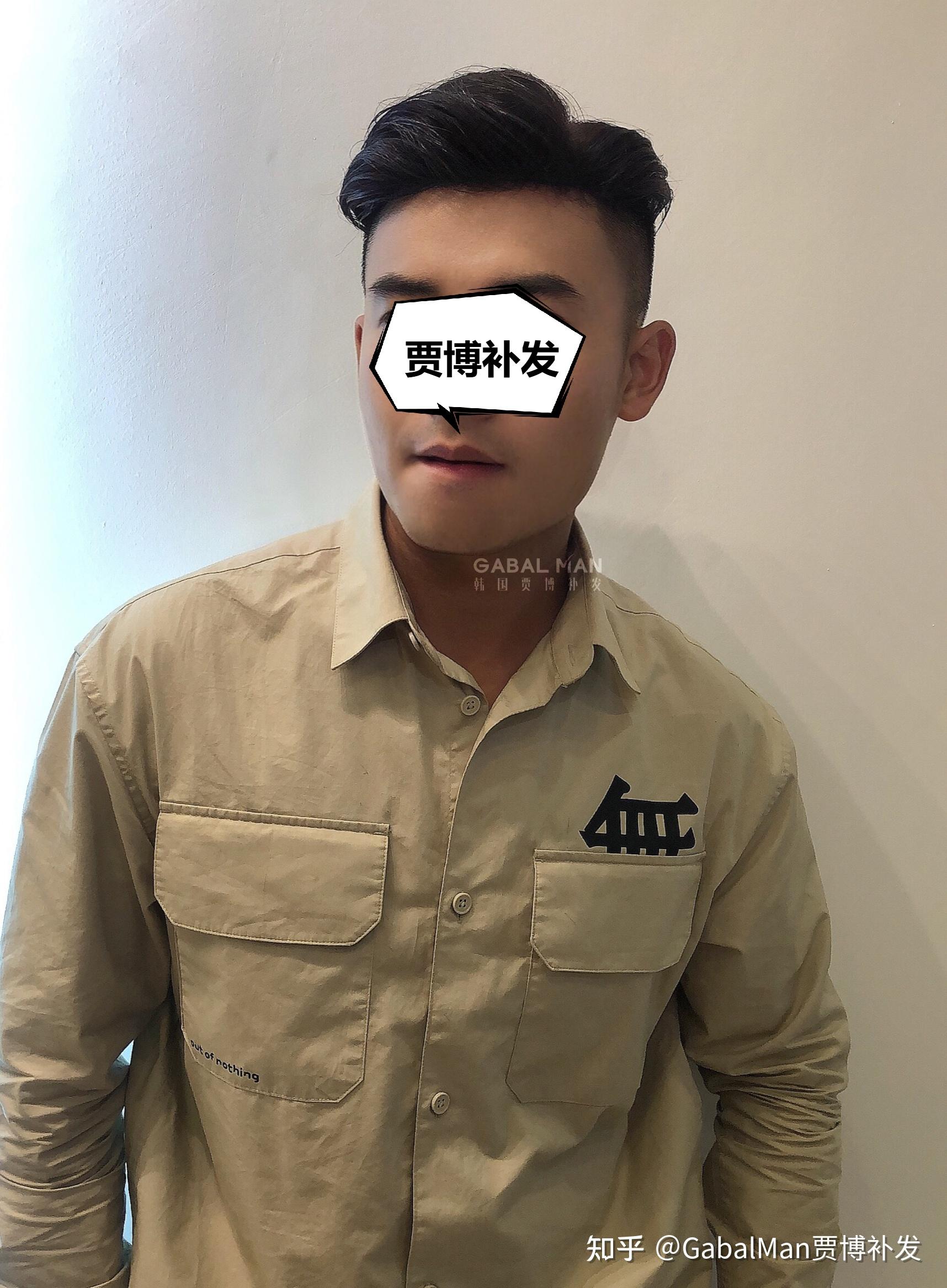 秃头大哥想做时尚背头贾博定制假发给你意想不到的帅气