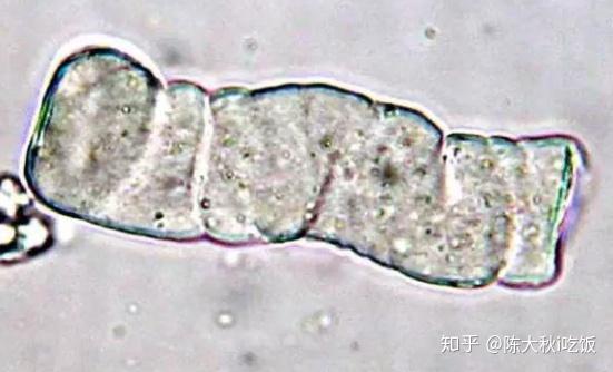 宠物尿液有形成分显微镜检查