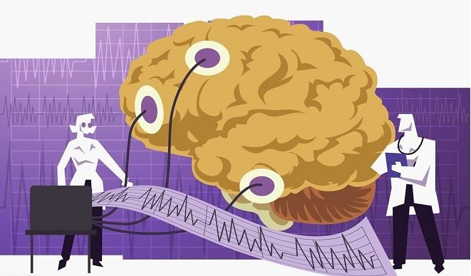 脑电图误区脑电图正常没得癫痫脑电图异常得癫痫