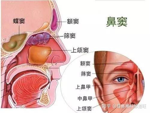 邹道旺医生科普耳鼻喉额窦炎有哪些疾病类型