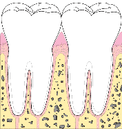 【泸州牙博士】智齿又上热搜了 | 原来你的真实面目是