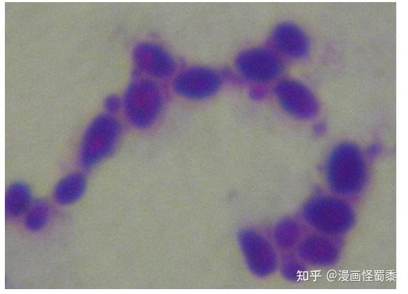 图3.链球菌 革兰氏染色