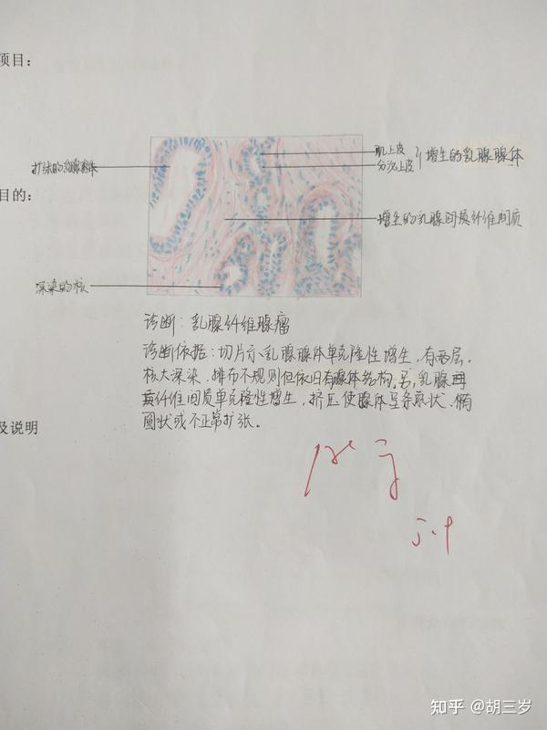 病理学切片红蓝绘图