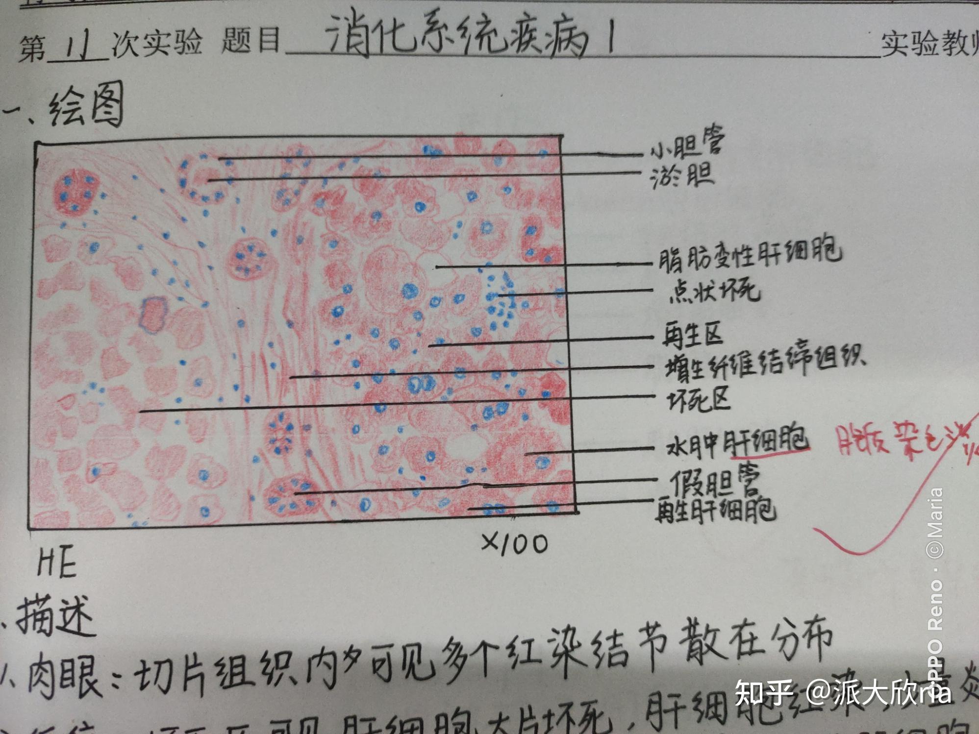 病理学实验报告红蓝铅笔手绘图有老师批改