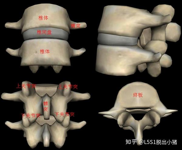 腰椎间盘突出症与手术