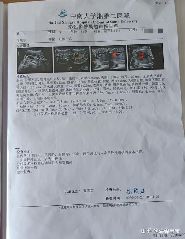 医生说胎儿心脏有点问题,三尖瓣轻度返流我也搞不懂为什么会这样,是