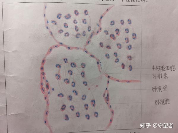 仅供参考的病理切片绘图