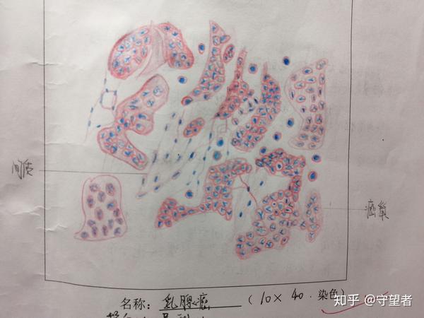 仅供参考的病理切片绘图