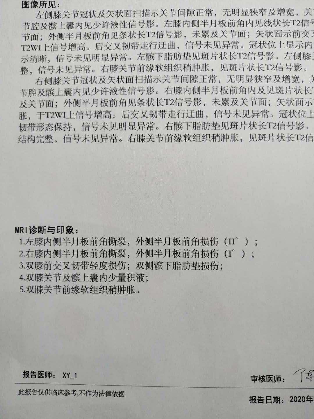 it 从业人员 25 人 赞同了该文章 2020年9月26号,双膝盖半月板损伤