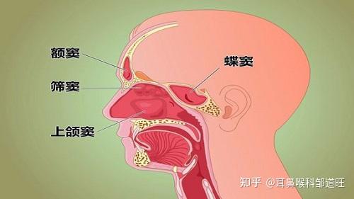 邹道旺医生科普耳鼻喉:额窦炎可引起哪些并发症?