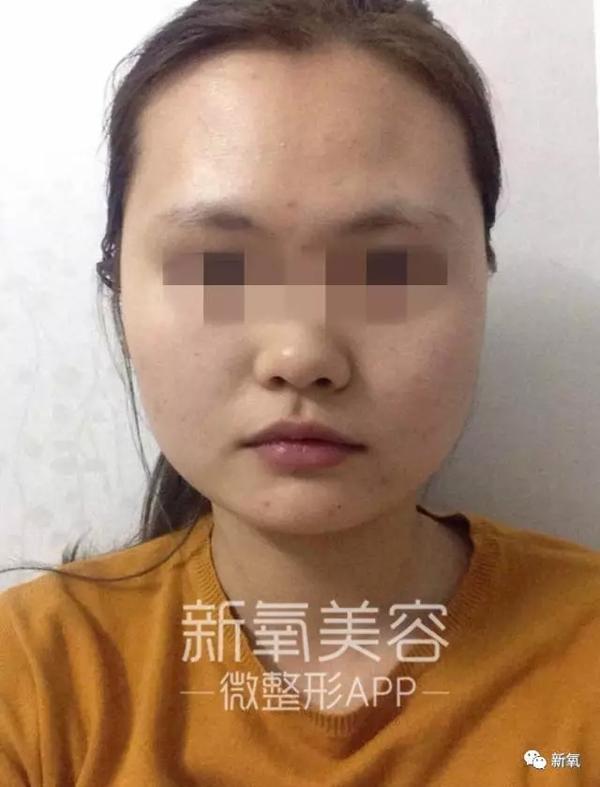 脸大的人都有哪些特征?你们有没有关心过自己的鼻颧角?