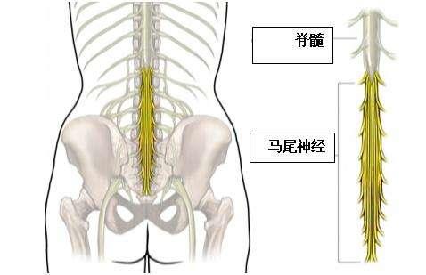 脊髓圆锥损伤和马尾神经损伤的区别是什么?