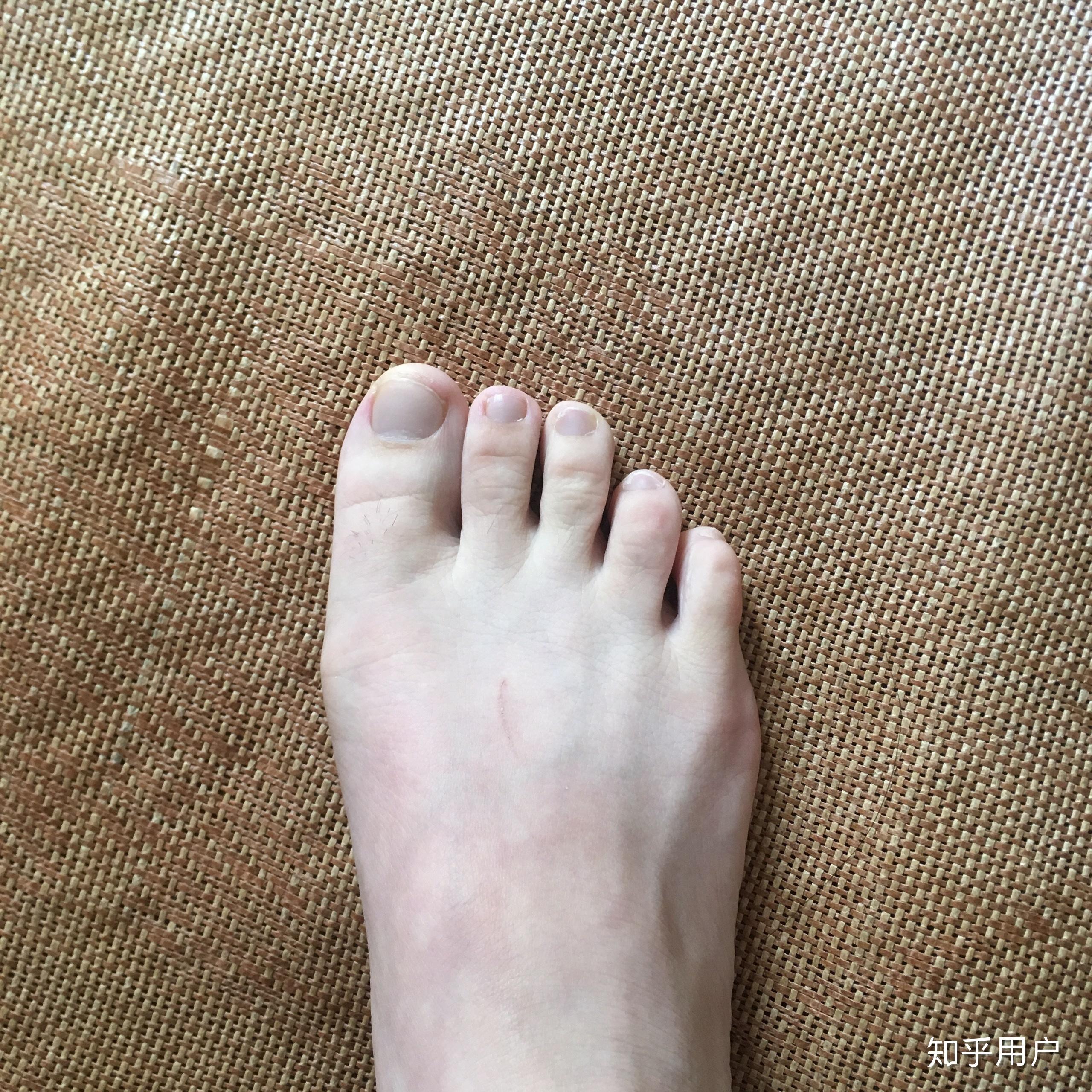 肉脚和瘦脚好看的脚型分别是什么样子的
