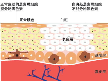 生成黑色素的关键酶——酪氨酸酶,你了解多少?