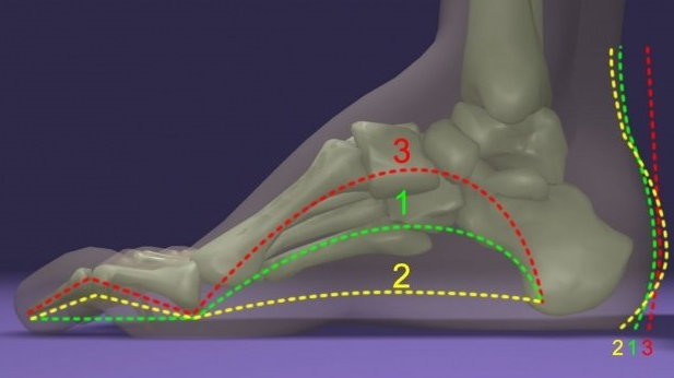 正常的足弓,其柔韧性较强,具有缓冲震荡和压力的作用.