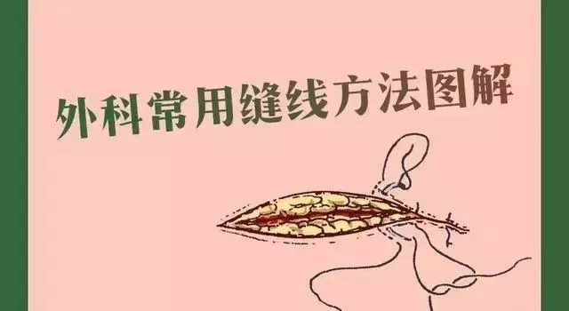 krackow缝合法图解,跟腱krackow缝合法 外科常用缝合方法图解