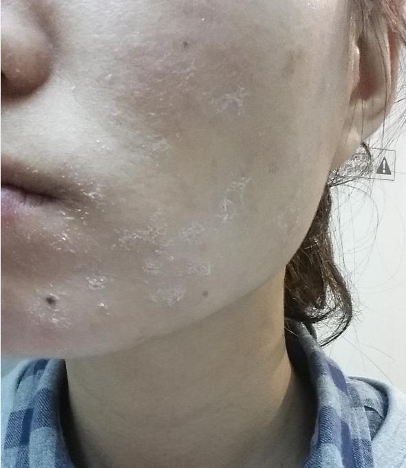 终于知道为什么一入冬就开始干燥脱皮了原因原来是这样