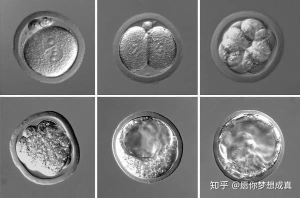 试管囊胚等级分类以及移植的成功率