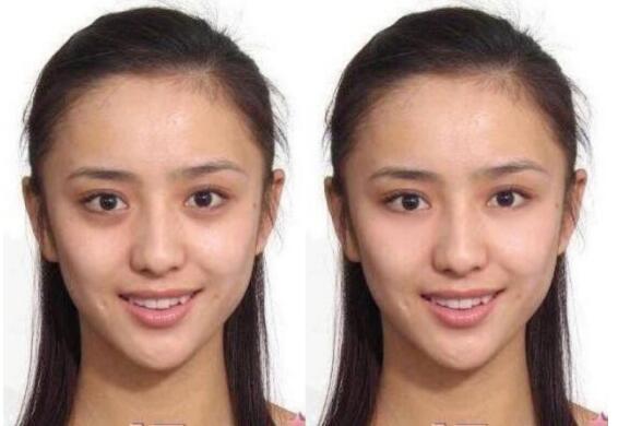 运动完的柳岩皮肤质感很好,去掉黑眼圈后,少女感马上也回来了!