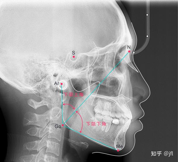 下颌上角 下颌下角
