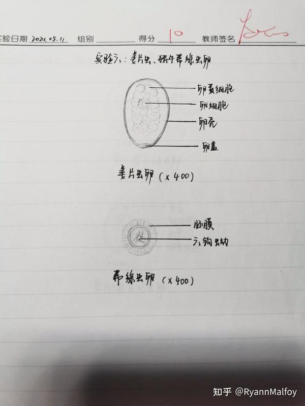 寄生虫手绘图 知乎