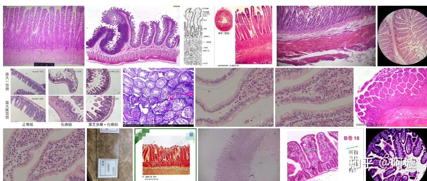 结肠和小肠在显微镜下怎么区分