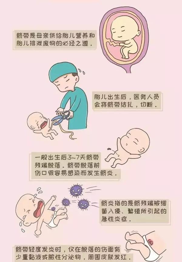 漫画详解新生儿脐炎护理方法,看月嫂是怎么预防的