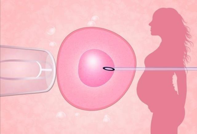 试管婴儿是把胚胎植入子宫的哪个位置 知乎