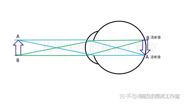 眼球屈光系统对a,b两个独立点的成像示意图