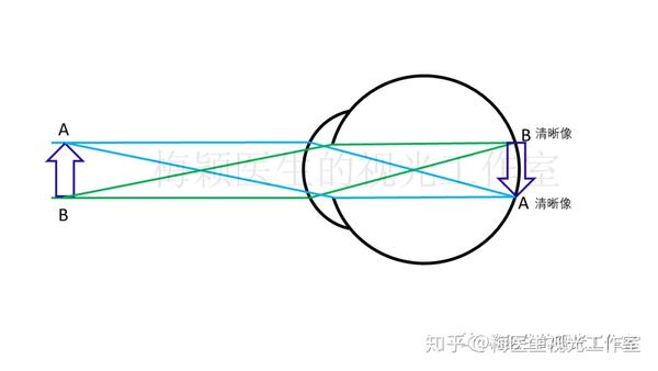 近视眼的视线在视网膜前交叉了,那视网膜像是正像?