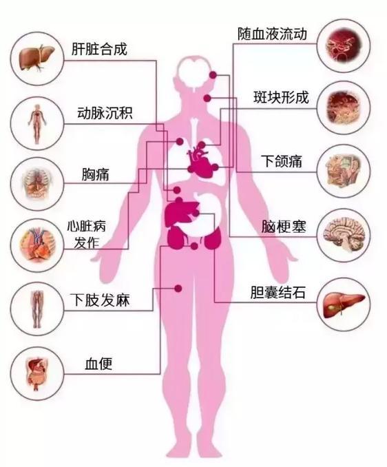 胆固醇变高的原因与危害与解决方法