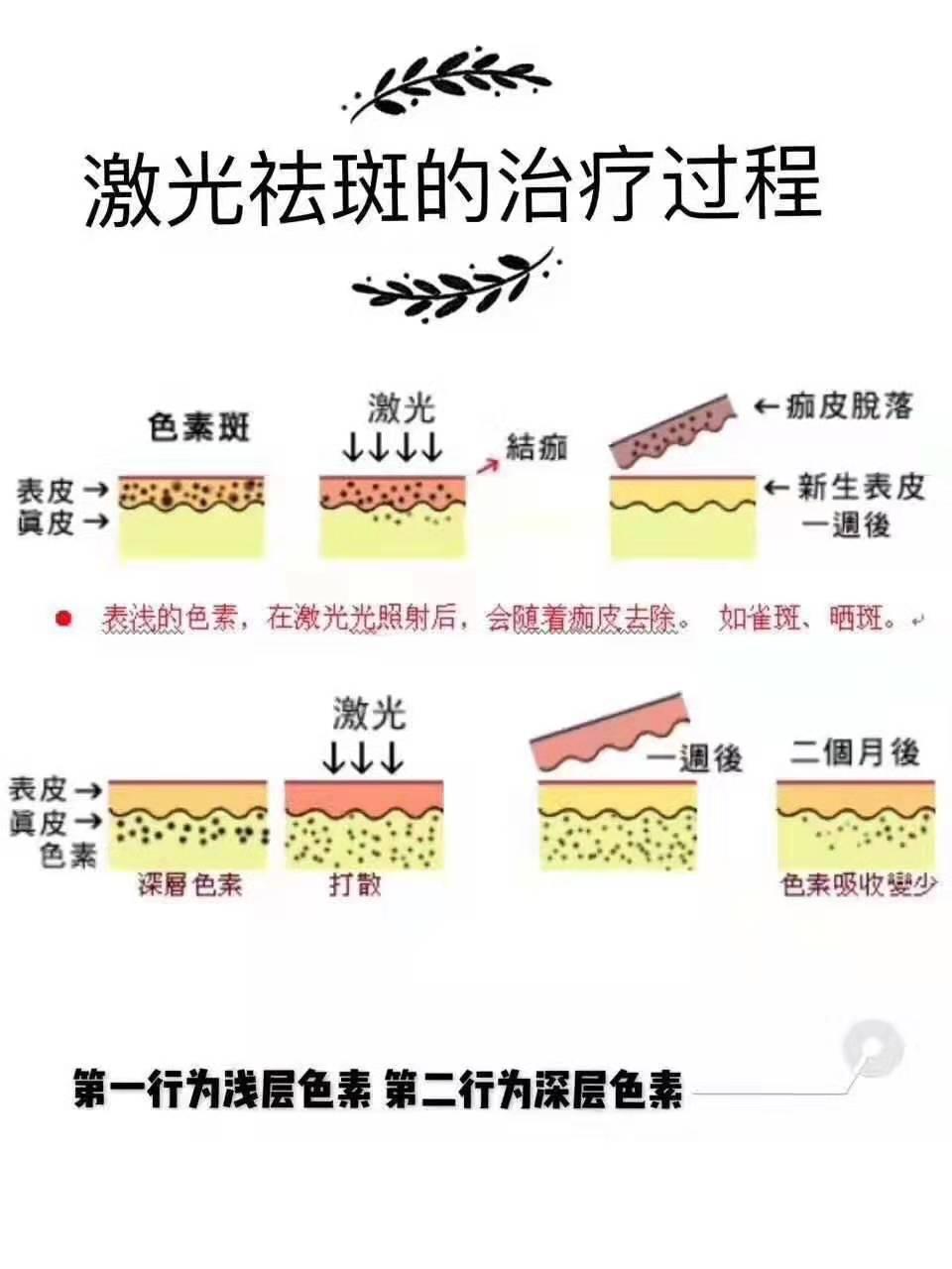 激光治疗皮肤病到底靠不靠谱