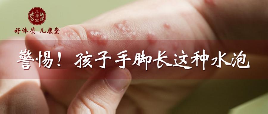 夏季汗疱疹高发长水泡发痒蜕皮是脾胃发出的求救信号