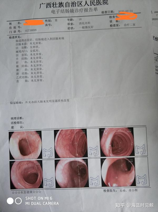 我这种属于肛窦炎吗?