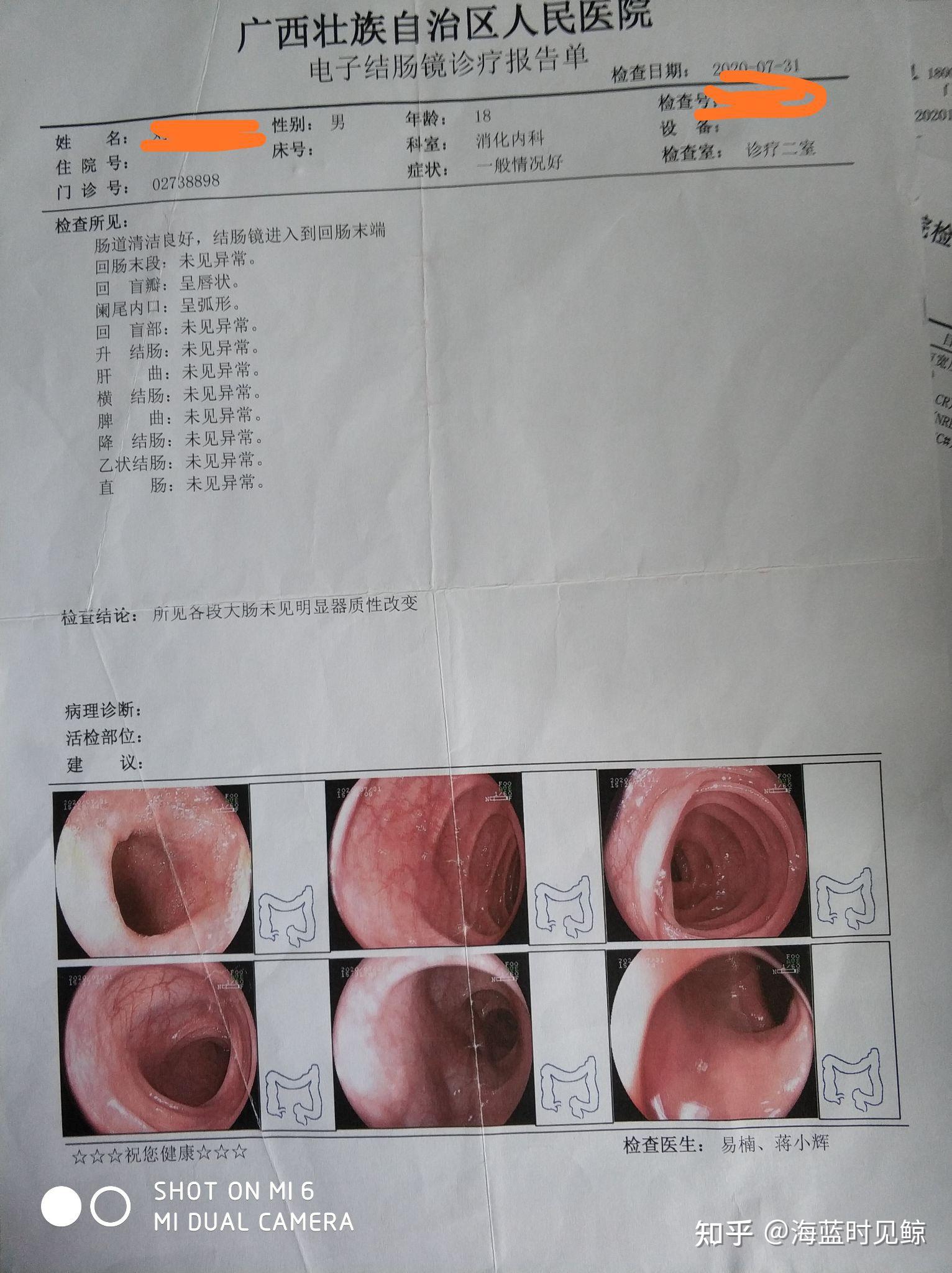 求大家帮帮我我这种属于肛窦炎吗