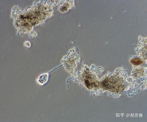 污水处理厂活性污泥的微生物显微镜检测功能作用及现状