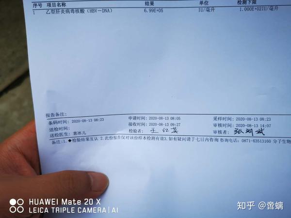 请教乙肝小三阳这个化验单怎么看