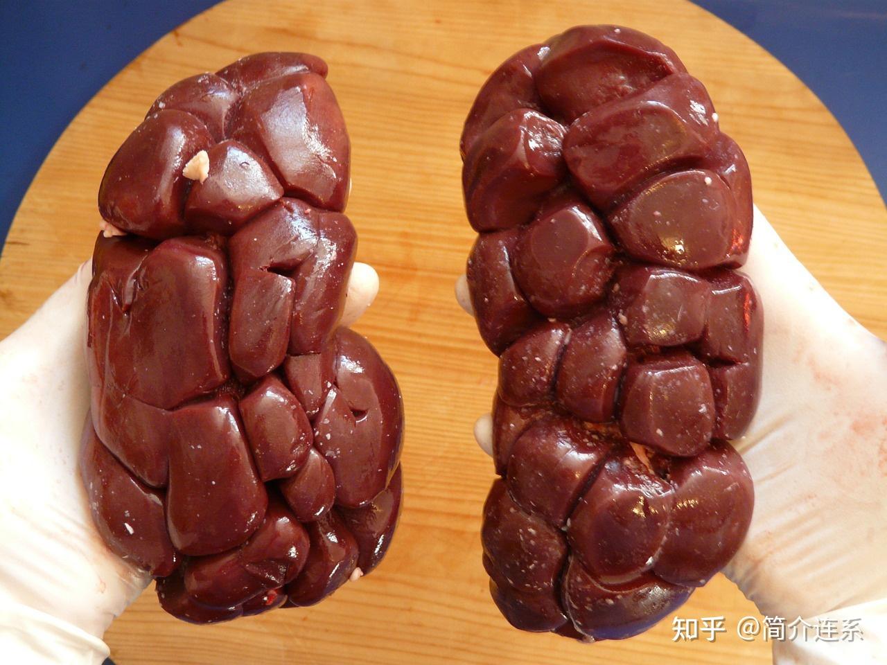 缅甸北部噶腰子视频