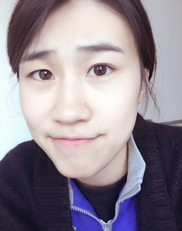 额头不饱满,而且还很窄,近视,长脸的女生适合什么发型