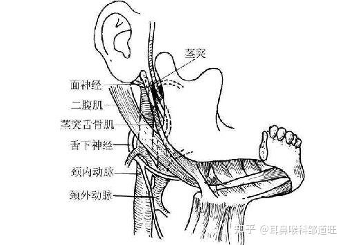 邹道旺医生科普耳鼻喉:茎突综合征需要怎么手术治疗?