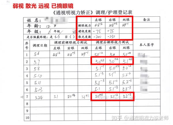 散光眼怎么恢复附成功案例