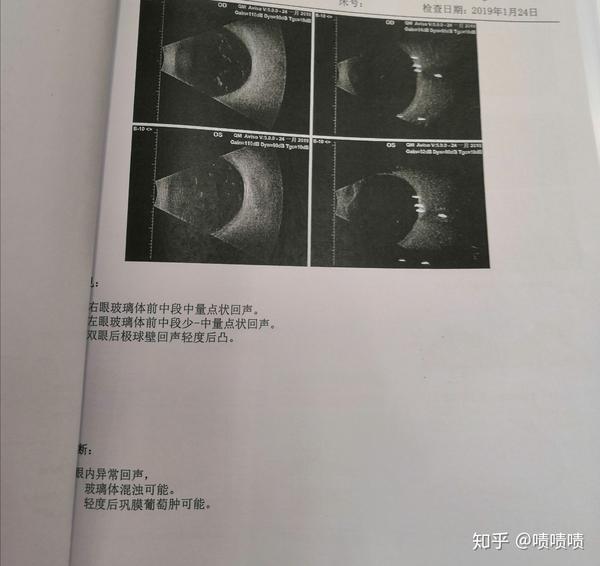 我这玻璃体混浊该怎么办需要注意什么下步是否就得激光或手术