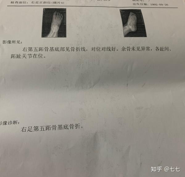 右足第五跖骨基底骨折日记