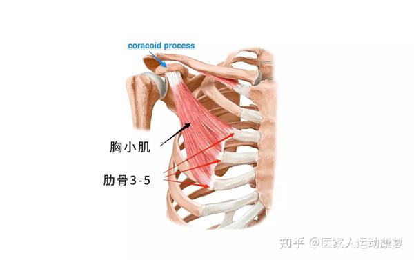 胸小肌过度紧张