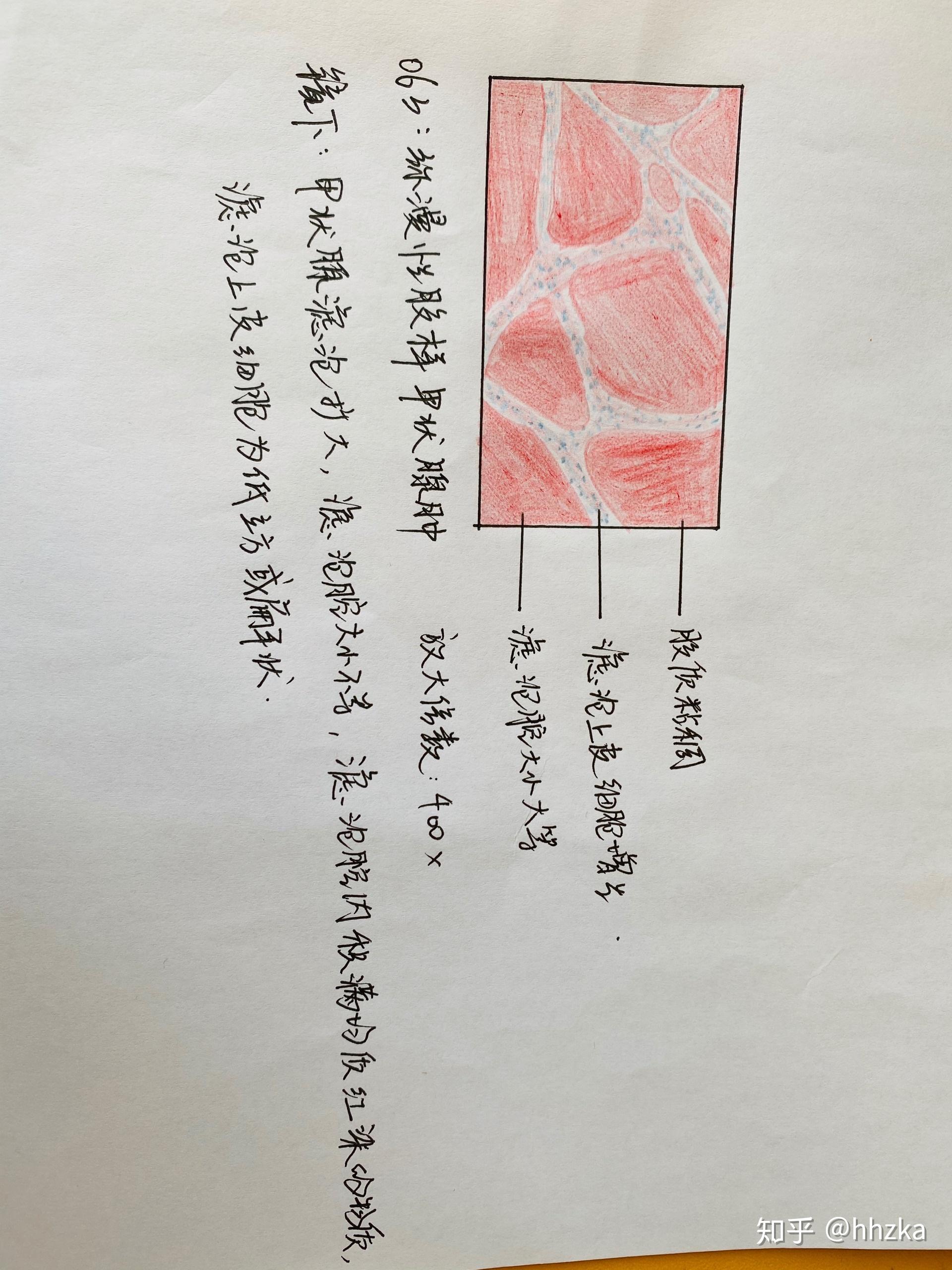 病理学切片红蓝铅手绘图