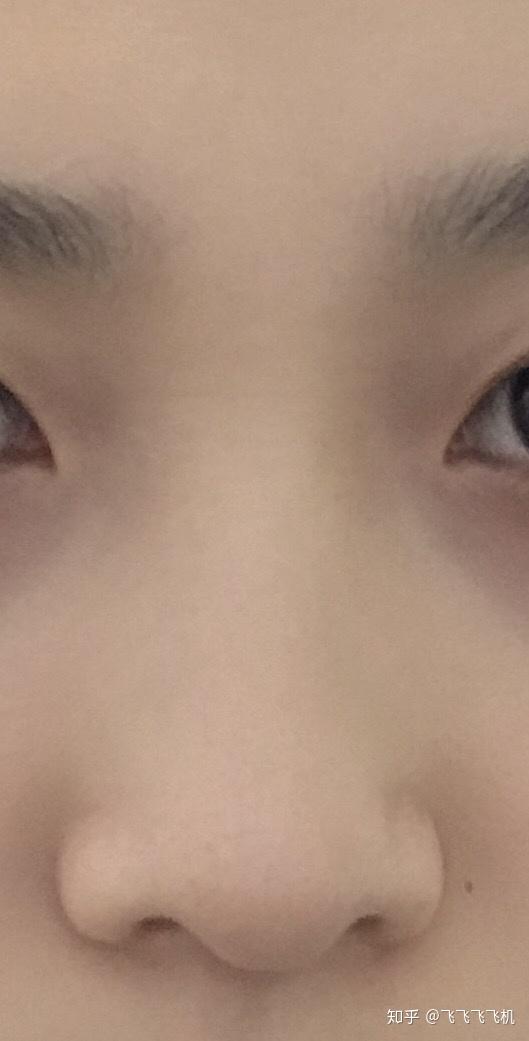 嘴型也不好看.