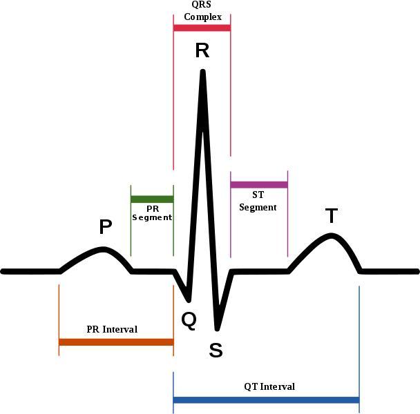 心电图常见的p波,qrs波和t波,pr间期指p波起始至qrs波起始