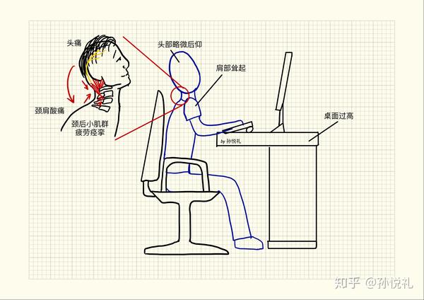 如何科学地用电脑:远离颈肩酸痛的人体工程学