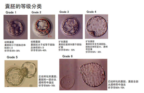 6天囊胚和5天囊胚那个好