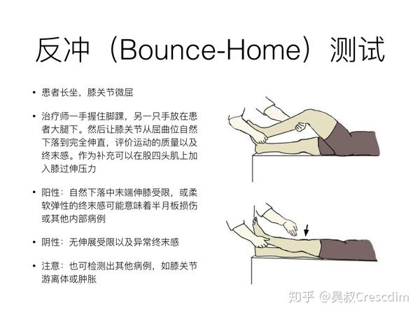 半月板损伤的5个徒手检查